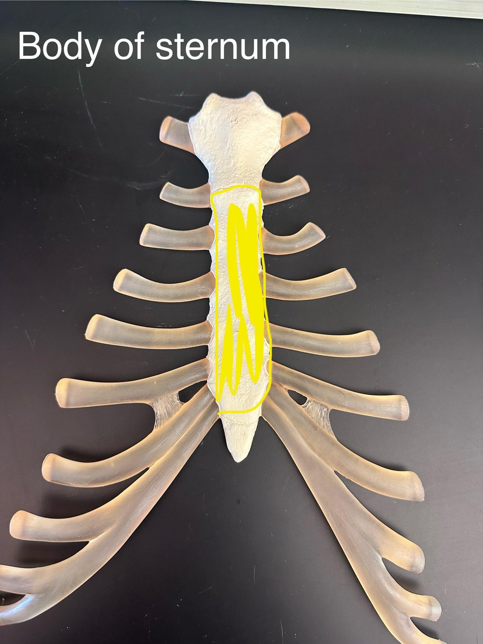 <p>Body of the sternum</p>