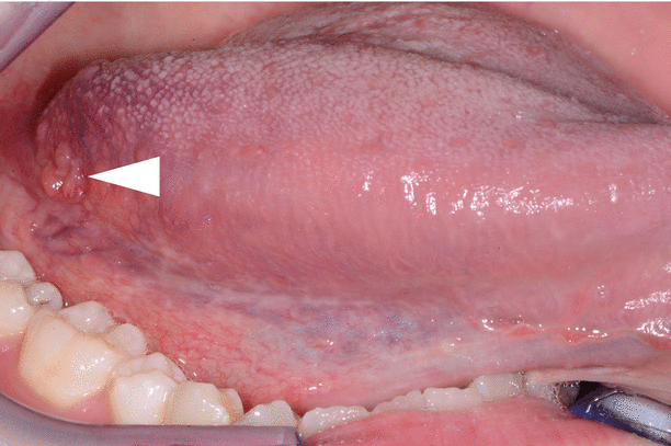 <p>What surface of the tongue is shown in the image?</p>