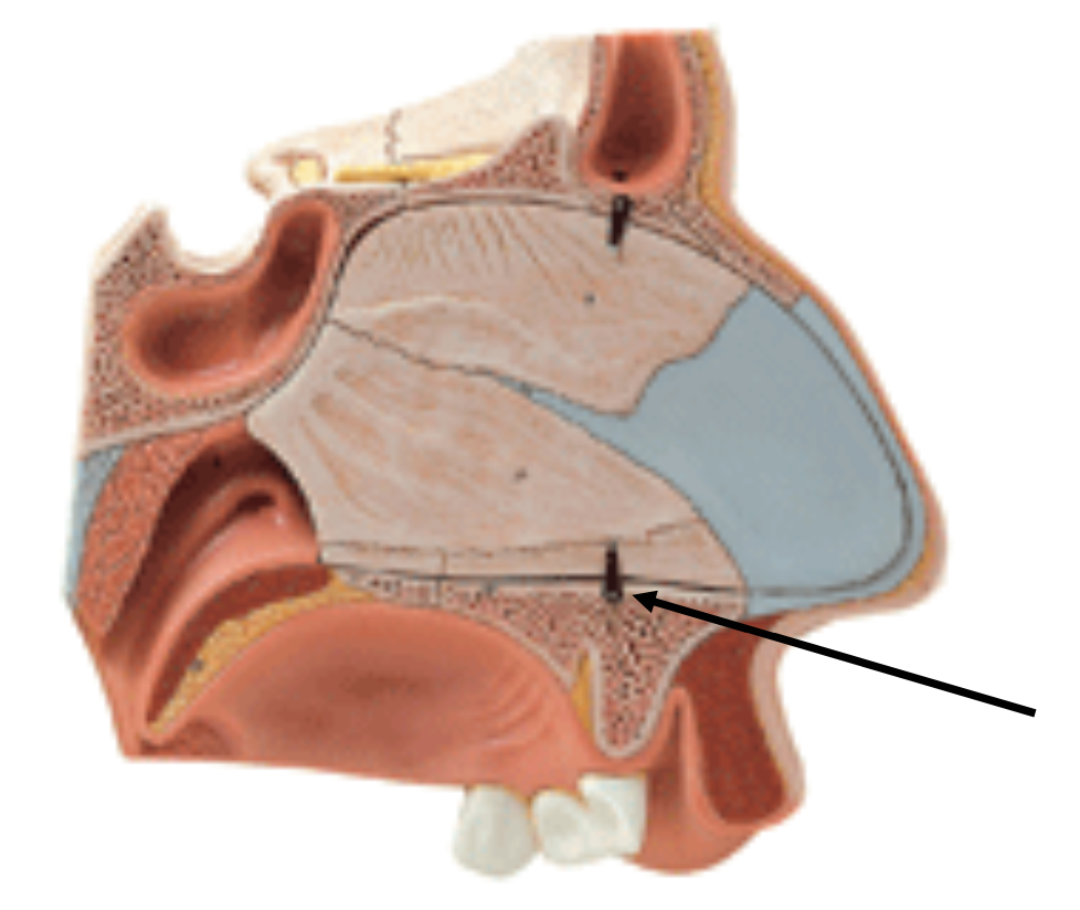 <p>This is a model of the nasal cavity. What bone is the arrow pointing to that forms part of the floor of the nasal cavity that is also the roof of the oral cavity?</p><p></p><p>A. ethmoid</p><p>B. nasal</p><p>C. maxilla</p><p>D. zygomatic</p>