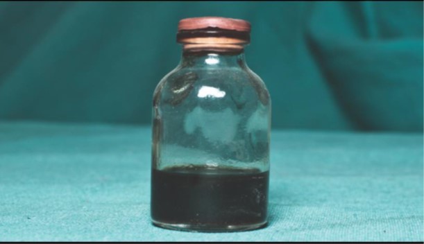 <p><strong><span>What is the diagnosis of this brown household poison?</span></strong></p><p><strong><span>What is its specific antidote?</span></strong></p>