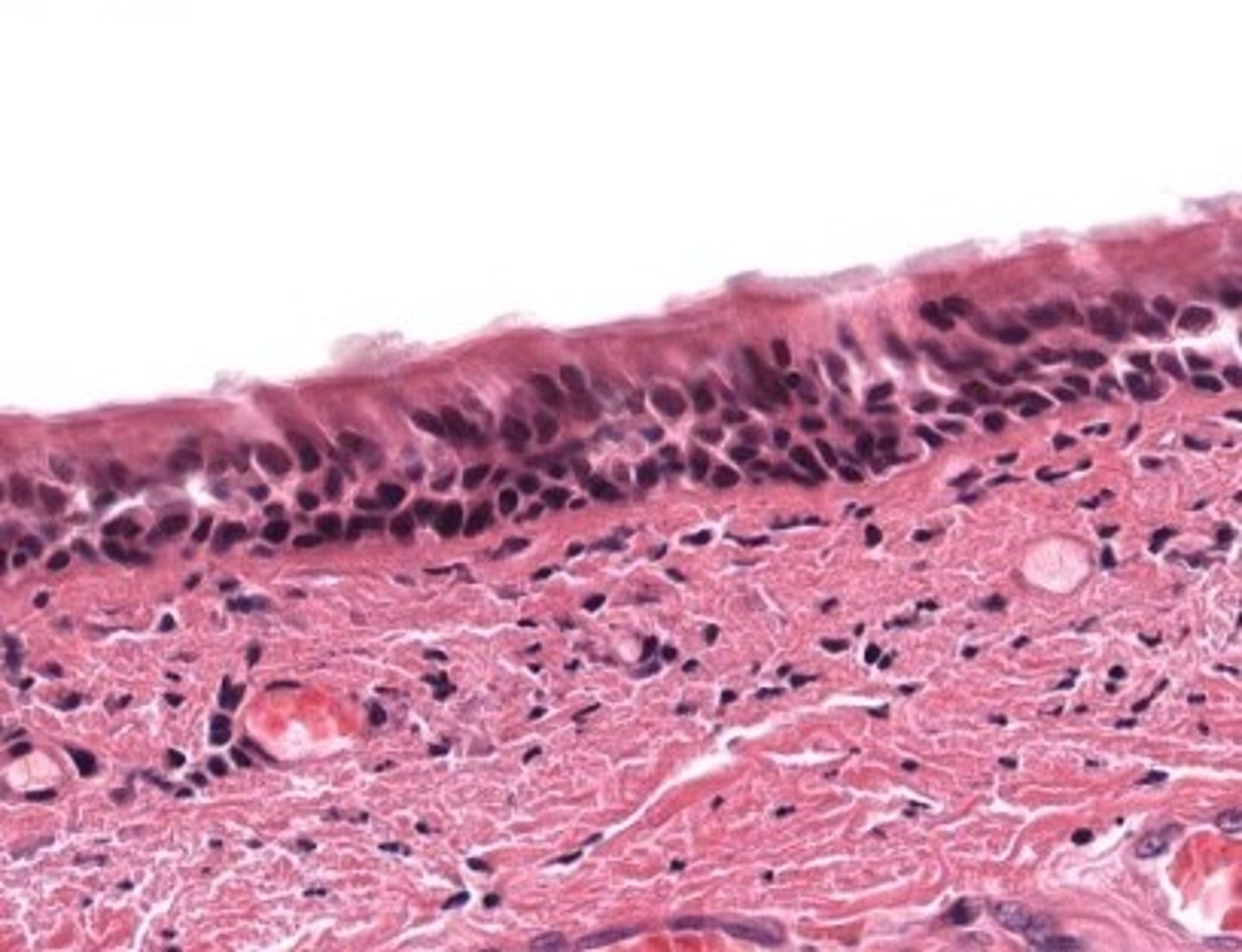 <p>trachea</p>
