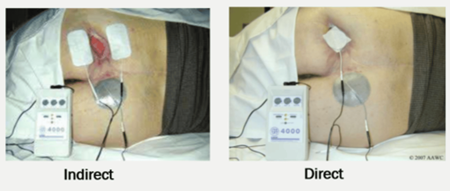 <p>WOUND HEALING MODALITY</p><p>direct or indirect high-voltage pulsed current (HVPC)</p><p>*evidence based treatment for chronic pressure wounds stage 2-4</p><p>INFLAMMATORY PHASE</p><p>- increases vasodilation, reduced edema, inhibits bacterial growth, prohibits migration of macrophages</p><p>PROLIFERATIVE PHASE</p><p>- stimulates protein and DNA synthesis in fibroblasts, promotes migration of healthy cells, generates angiogenesis and collagen formation</p>
