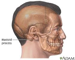 <p></p><p>&nbsp;&nbsp;&nbsp;&nbsp;&nbsp;&nbsp;&nbsp;&nbsp;&nbsp;&nbsp;&nbsp; <span style="font-family: Calibri, sans-serif">A vibrating tuning fork (256 Hertz) is placed on the mastoid process behind the ear. <strong>When the sound is no longer heard it is placed in line with the external meatus. </strong>Normally the sound is audible at the external meatus (as air conduction &gt; bone conduction). This is termed <em>Rinne-positive.</em></span></p><p class="MsoNormal"><span style="font-family: Calibri, sans-serif">&nbsp;</span></p><p class="MsoNormal"><span style="font-family: Calibri, sans-serif"><strong>With conduction [middle ear] deafness, no note is audible at the external meatus. This is termed <em>Rinne-negative.</em></strong></span></p><p class="MsoNormal"><span style="font-family: Calibri, sans-serif">&nbsp;</span></p><p class="MsoNormal"><span style="font-family: Calibri, sans-serif">With nerve deafness the note is audible at the external meatus, as air and bone conduction are reduced equally, so that air conduction is better as is normal i.e. <em>Rinne-positive.</em></span></p><p></p><p>put fork by ear after- should hear better when by ear</p>