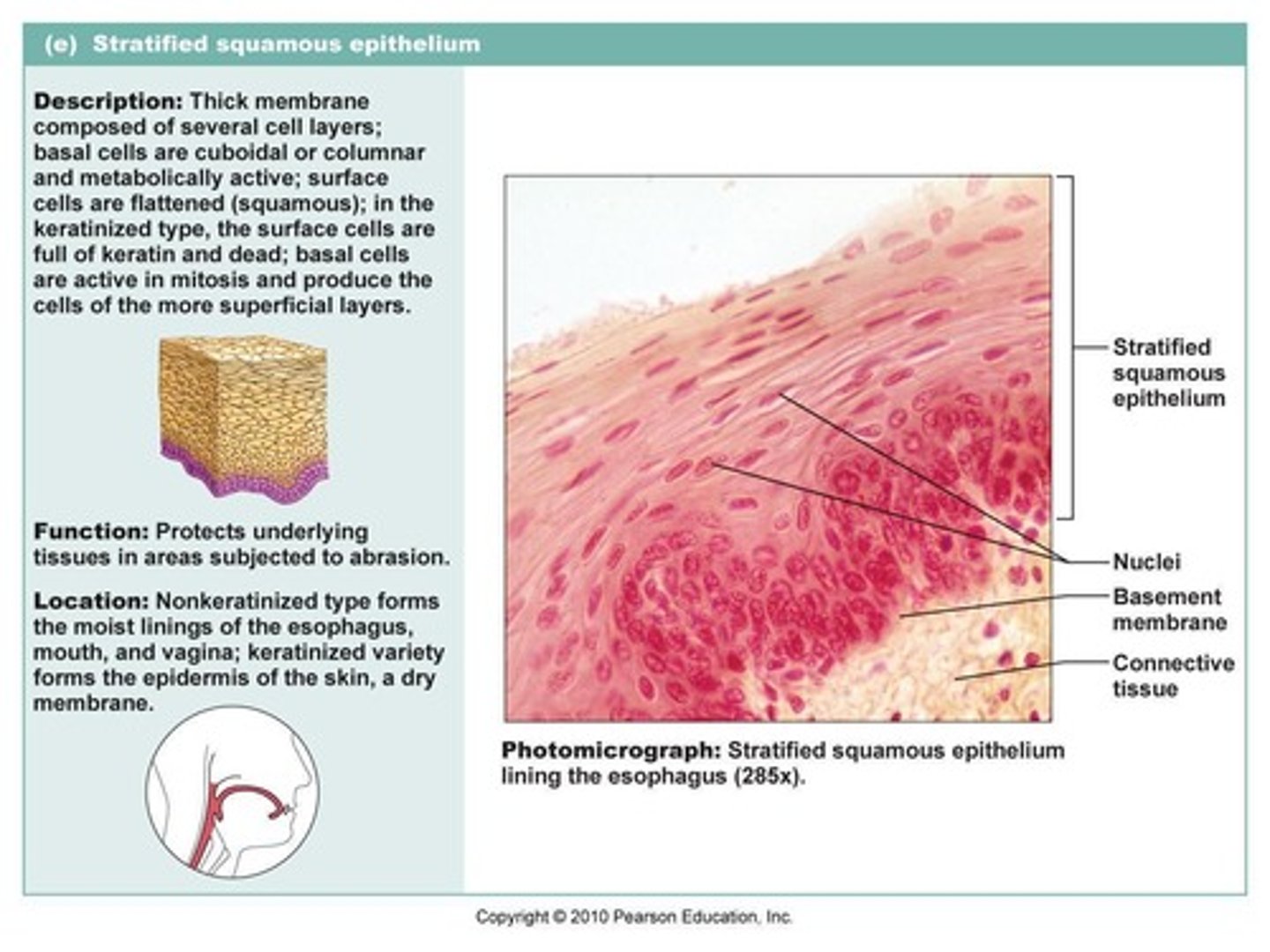 <p>a type of epithelial tissue where cells are flat and scale-like, specialized for diffusion or protection.</p>