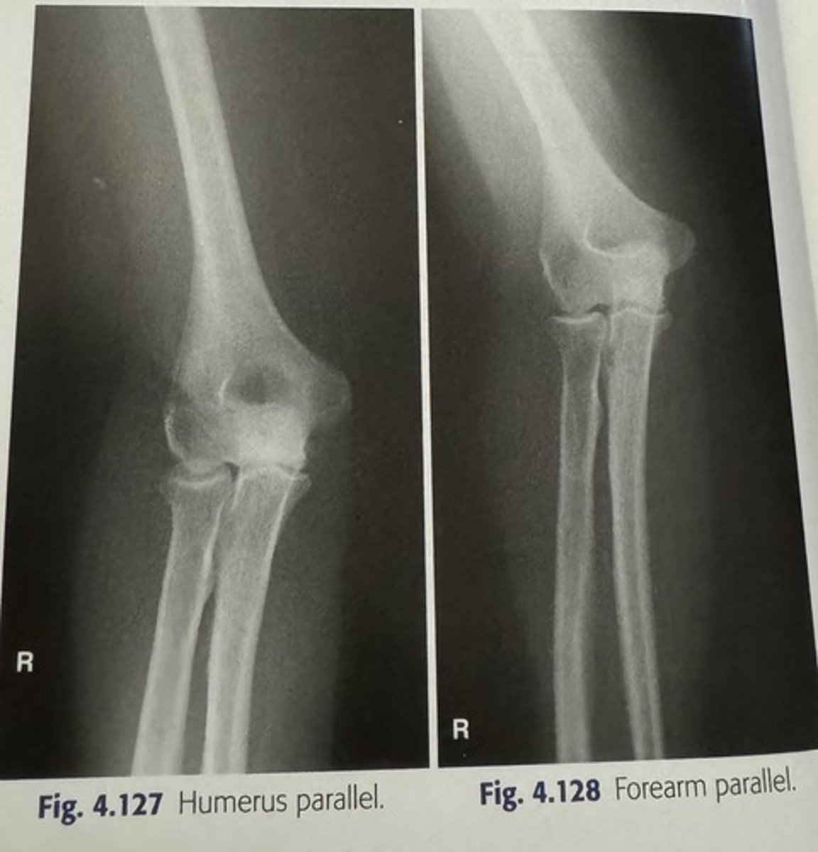 <p>-shorter</p><p>-anatomy/part</p>