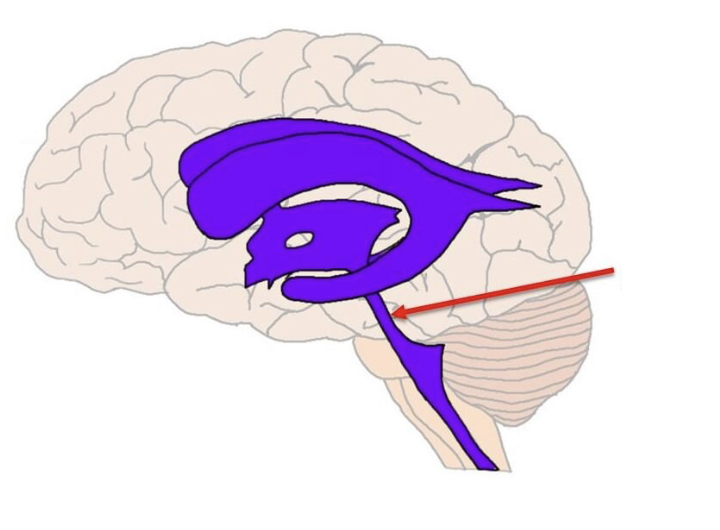 connection of the ventricular system between the third and fourth ventricles located in the midbrain