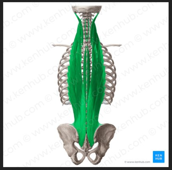 <p>Muscle of the face head and neck:</p><p>Erector Spinae</p>
