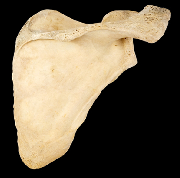 <p>Name this bone.</p><p>Left or right?</p><p>(Posterior view).</p>