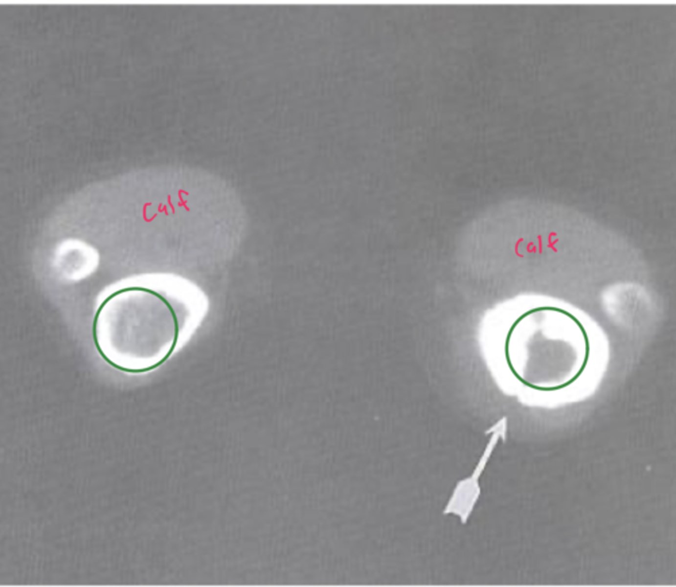 <p>What type of imaging is used for this?</p>