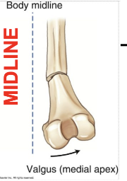 <p>What angulation is this?</p>