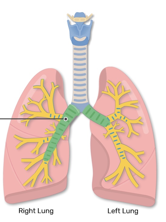 <p>The section of the bronchial tree that branches from the trachea is known as <strong><em><em></em></strong></em>__.</p>