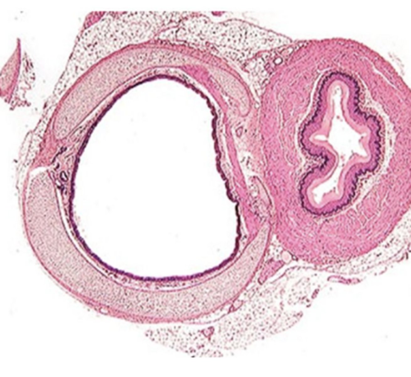<p>small circle with spongebob sky shape</p>