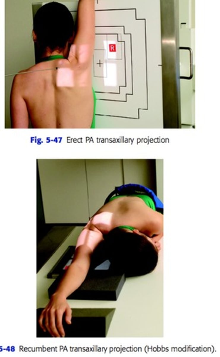 <p>perpendicular to axilla and humeral head (patient is 5-10° anterior oblique)</p>