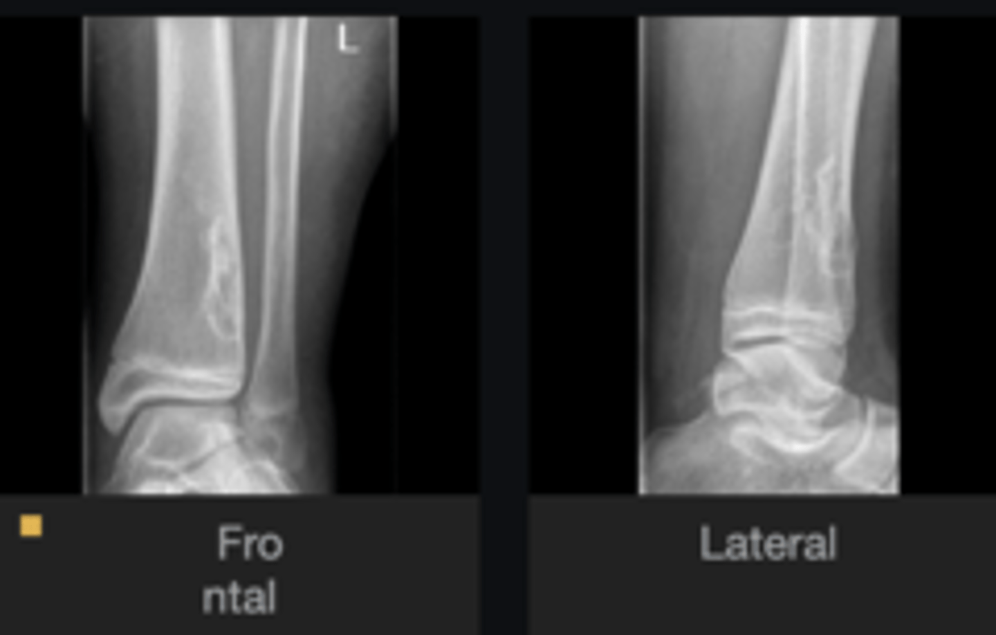 <p>Diagnosis?</p>