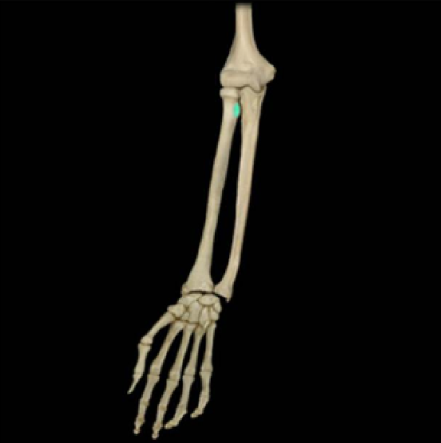 term image