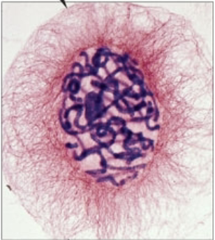 <p>what stage of mitosis?</p>