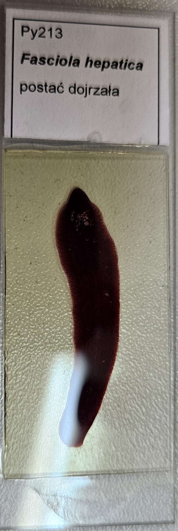<p><strong><em>Fasciola hepatica</em></strong></p><p>(Postać dojrzała)</p><p></p><p></p><p><strong>Parazytoza:</strong><em> Fascjoloza</em></p>
