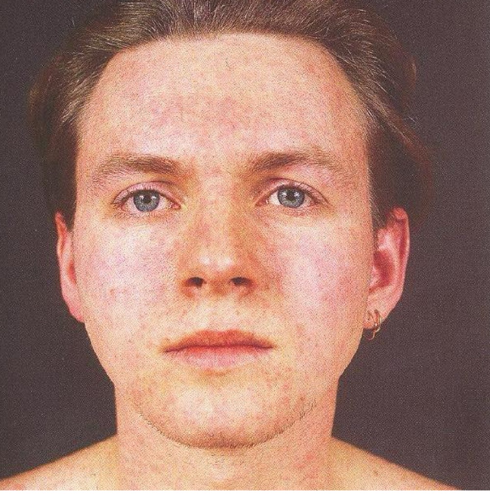 <p>what infection is this?</p>