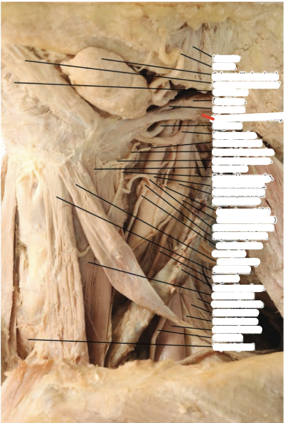 Identify the structure (red line)