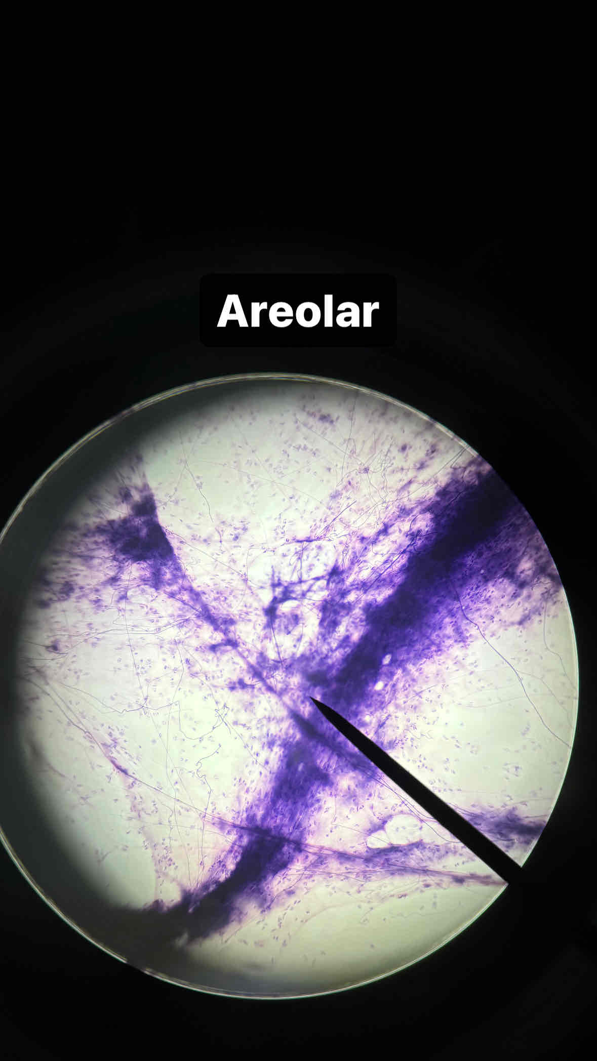<p><span>type and subtype of tissue?</span></p>