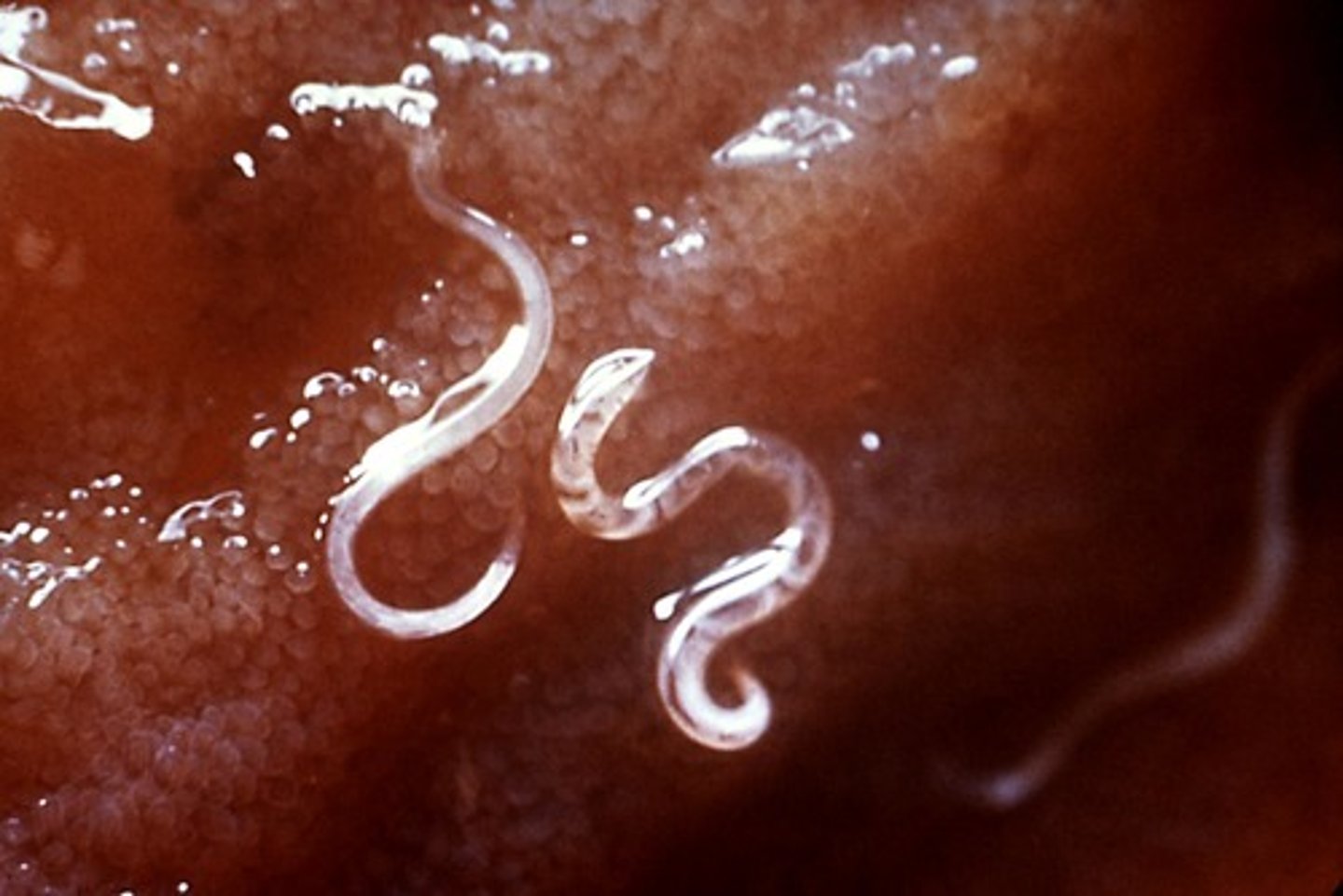 <p>parasitic worms</p>
