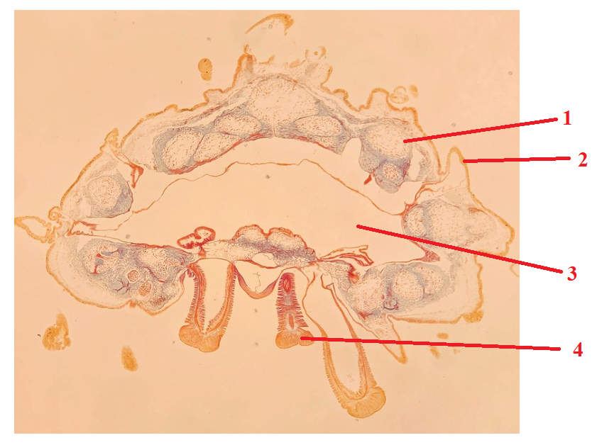 <p>Phylum?<br>subphylum?<br>Symmetry? Tissue type?<br>Cavity?<br><br>1/2/3/4?</p>