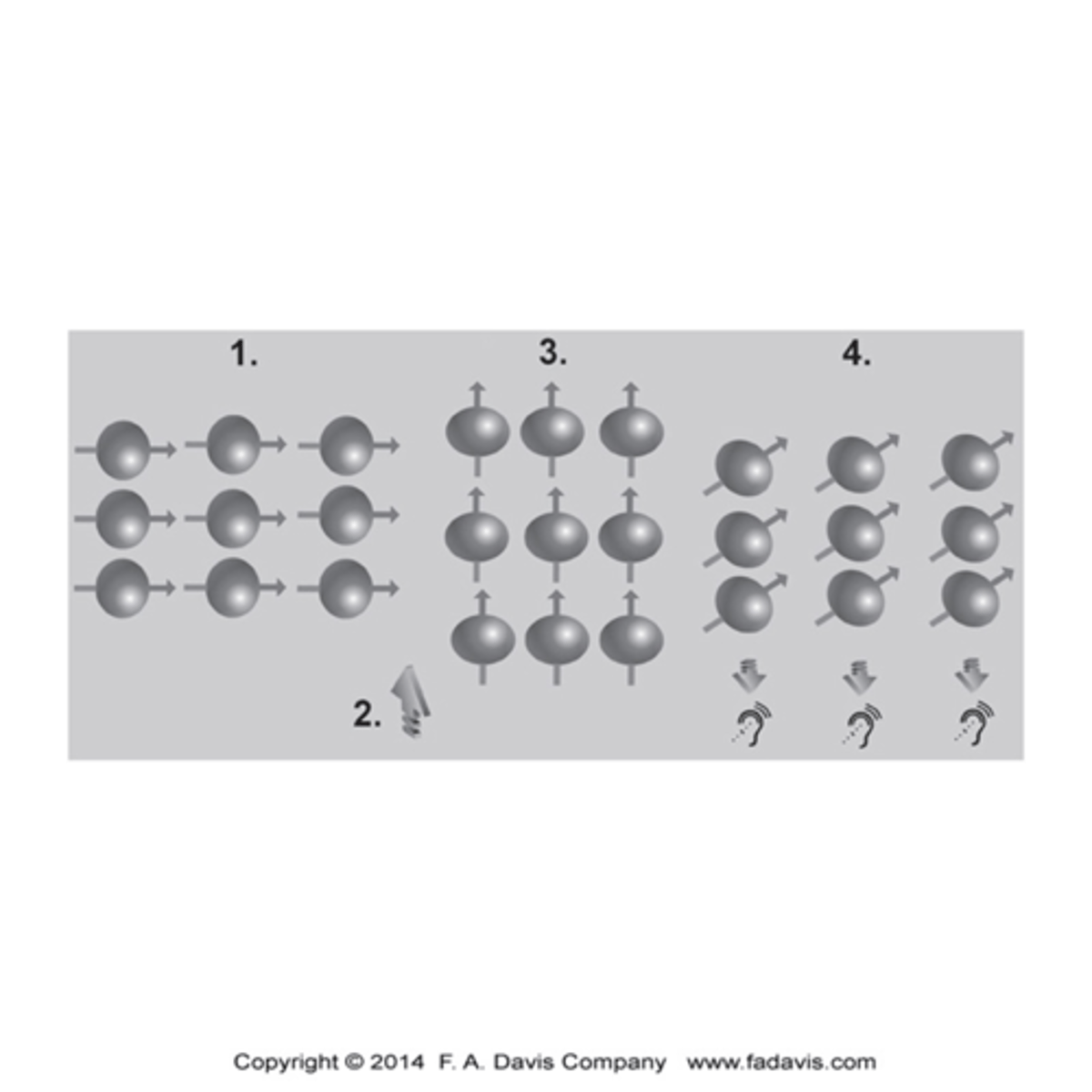 <p>1.The magnetic field in the scanner causes the hydrogen nuclei in water molecules to align relative to the field.</p><p>2.A pulse of radiofrequency waves is applied, and this pulse knocks the protons out of alignment, and energy is absorbed in the process.</p><p>3.After the radiofrequency pulse is turned off, the protons realign with the magnetic field and release their absorbed energy</p><p>4.Because each soft tissue has a different amount of water content, it will absorb and release energy at different rates.</p><p>5.The measurement of the differences in these energy levels is what is used to create the image.</p>