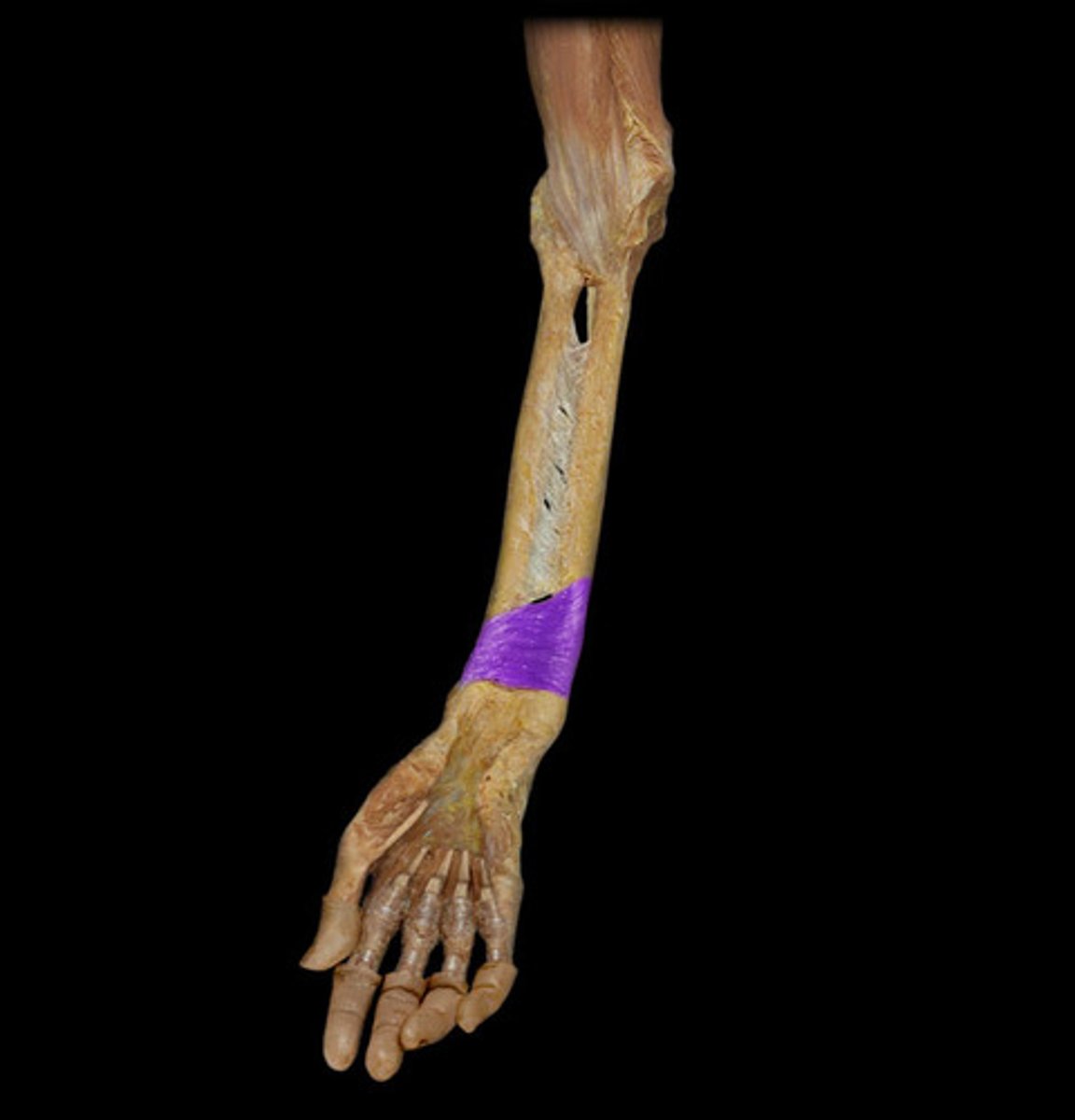 <p>What is this muscle, and what is its action, Proximal &amp; Distal insertions?</p>