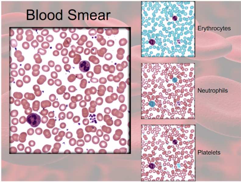 <p>Matrix of blood: Plasma— clear, light yellow fluid</p><p>Cells: RBC, WBC, and platelets</p>