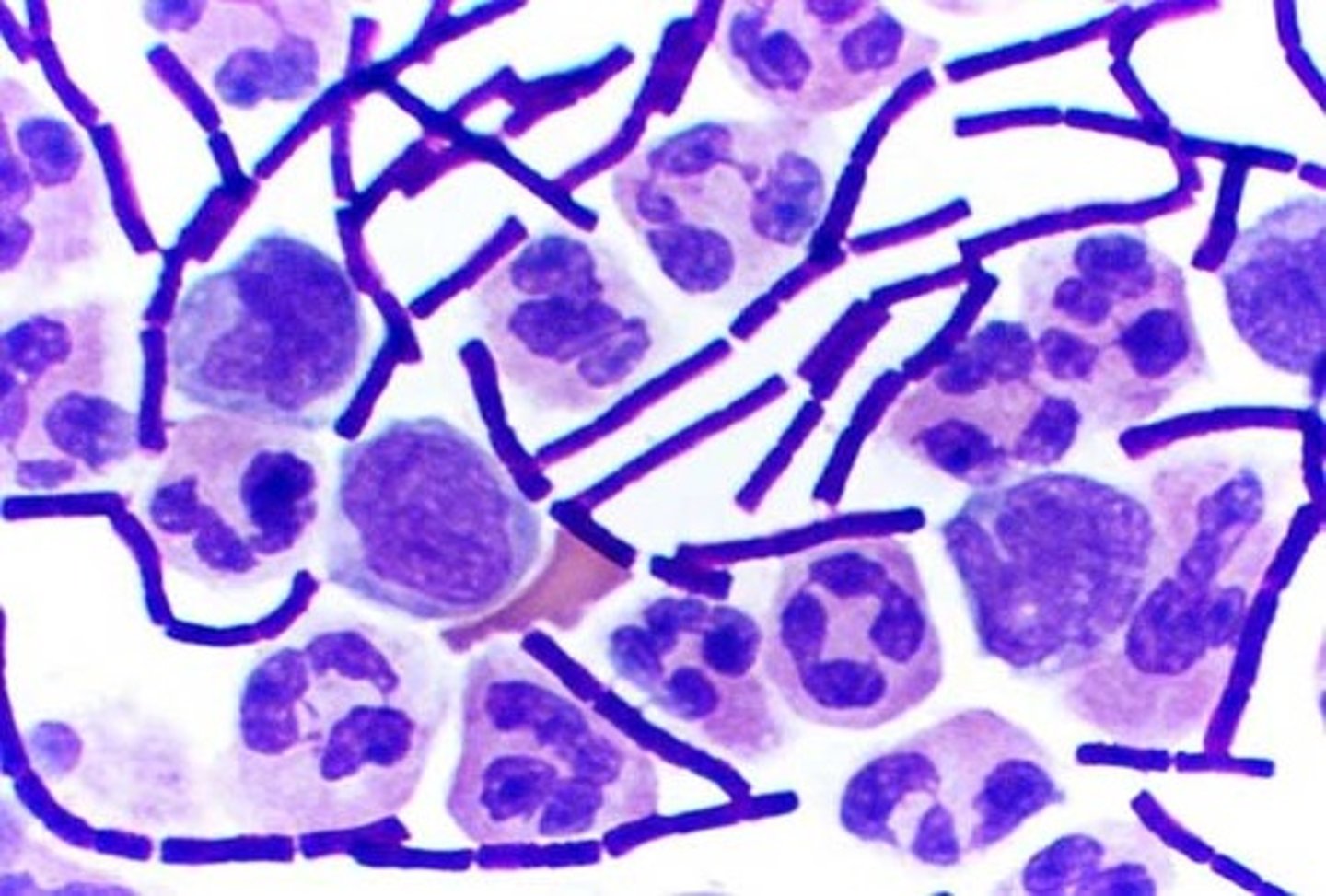 <p>gram positive</p>