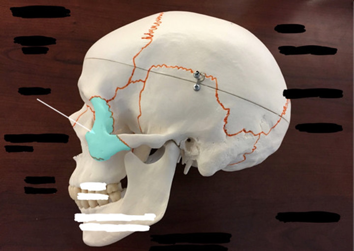 <p>What bone is highlighted here?</p>