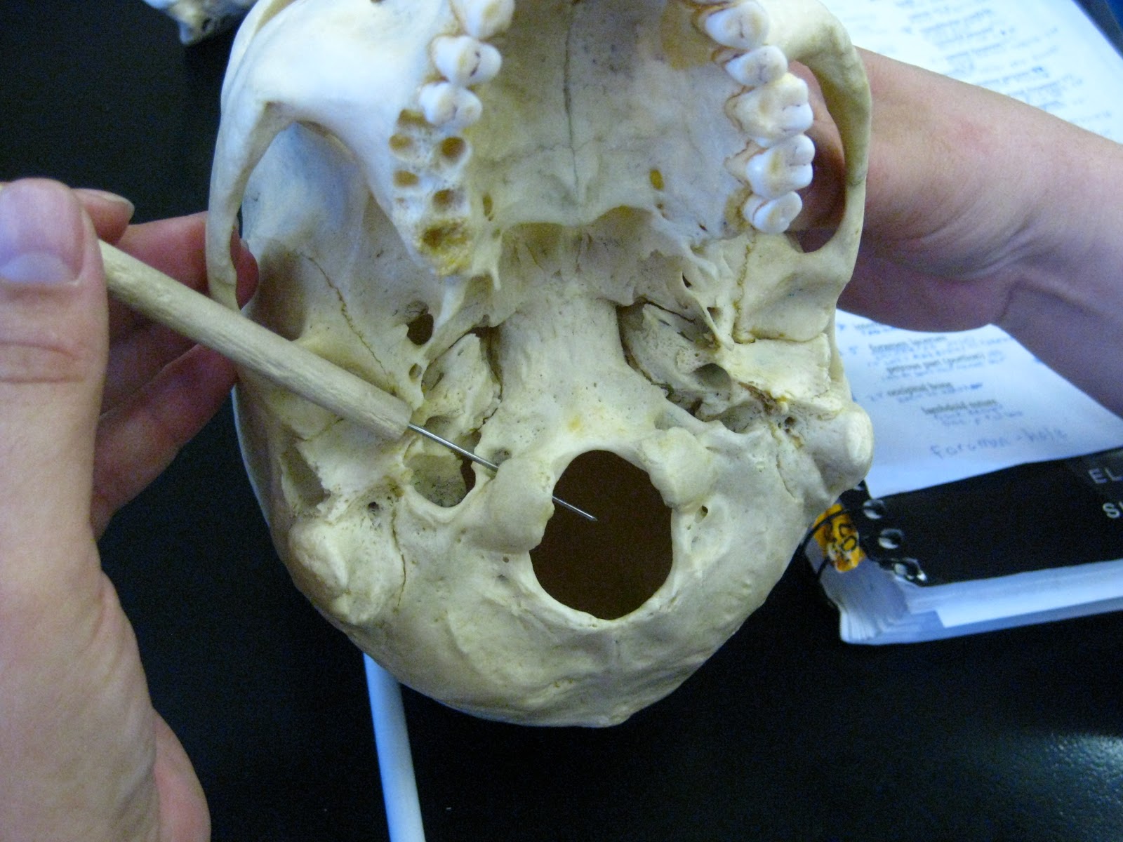 <p>underneath occipital condyles; passageway runs horizontally</p>