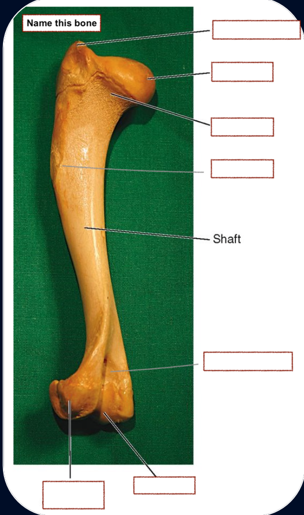 <p>Greater Tubercle</p><p>Olecranon fossa</p><p>Head</p><p>Neck</p><p>Condyle</p><p>Epicondyle</p><p>Deltoid Tuberosity</p>
