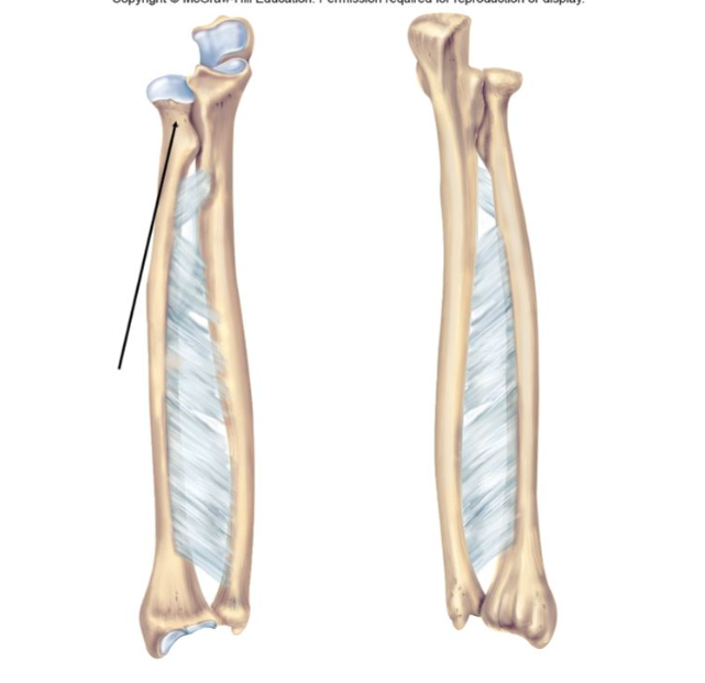The structure indicated in the figure is the
