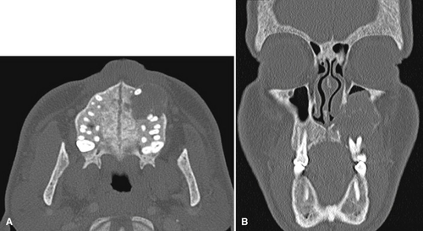 <p>What is the pathology in the radiographs?</p>