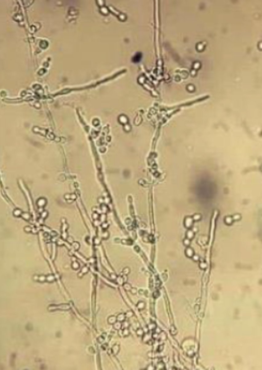 <p>- Rare</p><p>- Hyphae (branches)</p><p>- Very serious -- let doctor know immediately</p>