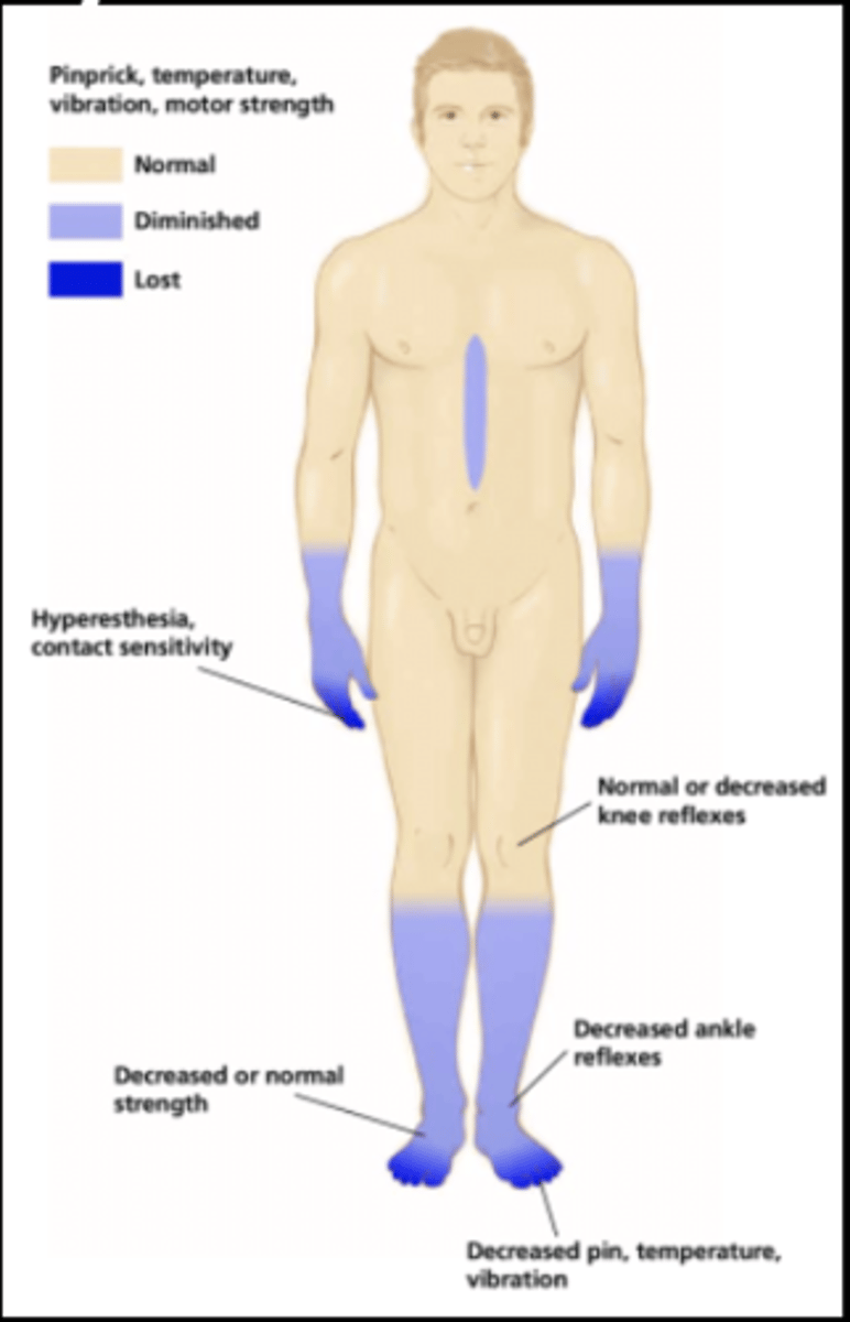 <p>develops at fingertips and toes</p><p>symptoms include</p><p>-tingling</p><p>-numbness</p><p>-paresthesia</p><p>-temperature sensitivity</p><p>-pain</p><p>-feeling of wearing gloves/stockings</p><p>-weakness</p><p>-impaired balance (due to decreased ankle and knee reflexes as well as sensory impairments)</p>