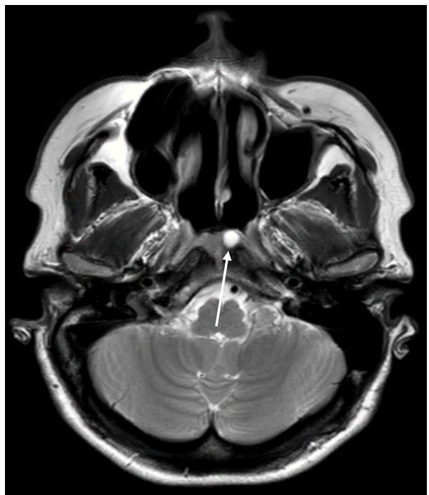 <p>What does this MRI image show, and which phase?</p>