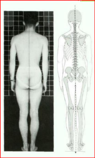 <p>Câu 29: <span style="color: yellow;">(Nhìn sau)</span> <span style="color: rgb(185, 113, 28);">Khớp hông</span> phải ở<span style="color: blue;"> vị thế </span>nào?<span>&nbsp;</span></p><p class="MsoNormal">A. <span style="color: red;">Trung tính</span>, <span style="color: green;">không áp</span> (adduction) hay <span style="color: green;">không dang</span> (abduction)<span style="font-family: "Segoe UI Symbol", sans-serif;"><span>✓</span></span><span>&nbsp;</span></p><p class="MsoNormal">B. Gập nhẹ<span>&nbsp;</span></p><p class="MsoNormal">C. Duỗi quá mức<span>&nbsp;</span></p><p class="MsoNormal">D. Xoay ngoài<span>&nbsp;</span></p>