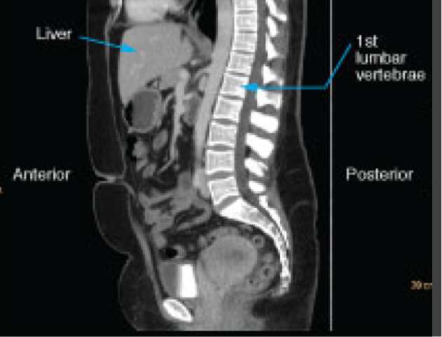 <p>Shown as though the patient is looking towards the viewer’s left </p>