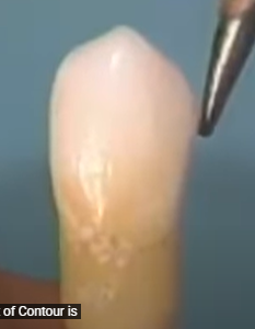 <p>On Mand canine the mesial cusp ridge is ______ than the distal cusp ridge&nbsp;</p>