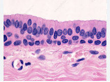 <ul><li><p>surface cells are columnar, cells underneath vary in size and shape </p></li><li><p>rare in body </p></li><li><p>male urethra/ parotid gland </p></li></ul><p></p>