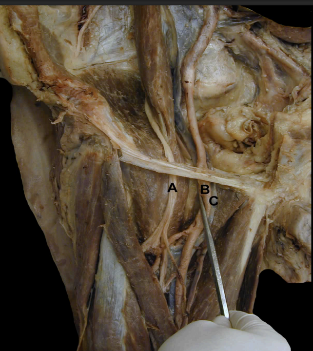 <p>Identify the structures indicated of this <strong>Anterior View </strong>of the Thigh’s<strong> Femoral Triangle </strong></p>