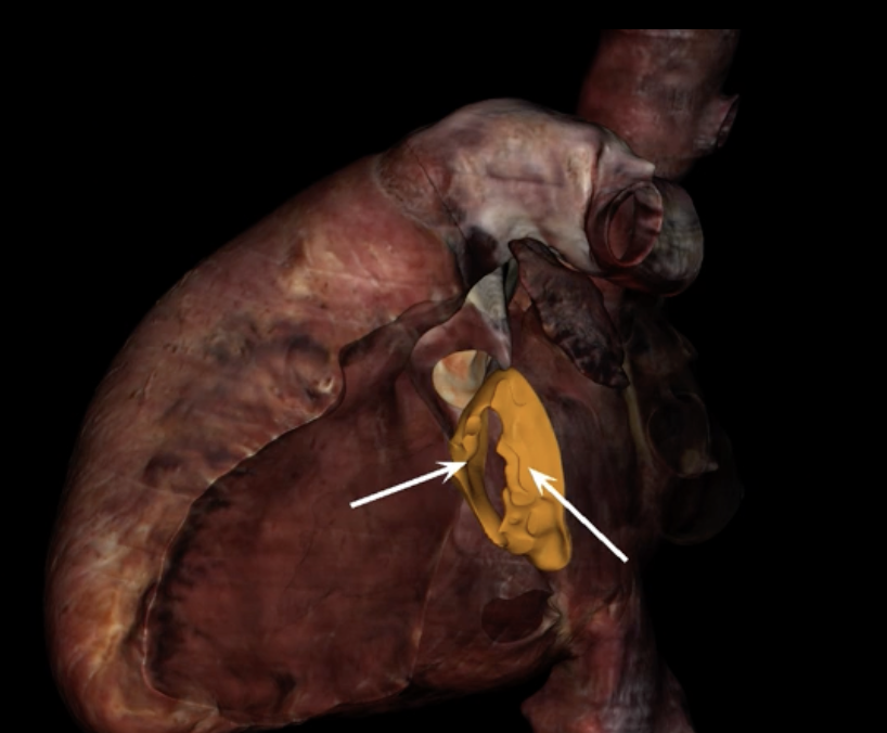 <p>What are the arrows pointing to?</p>