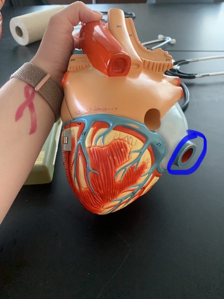 Name the heart structure.