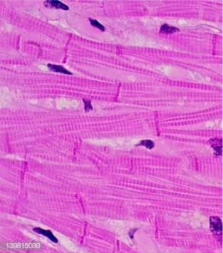 <ul><li><p>striated</p></li></ul><p></p>