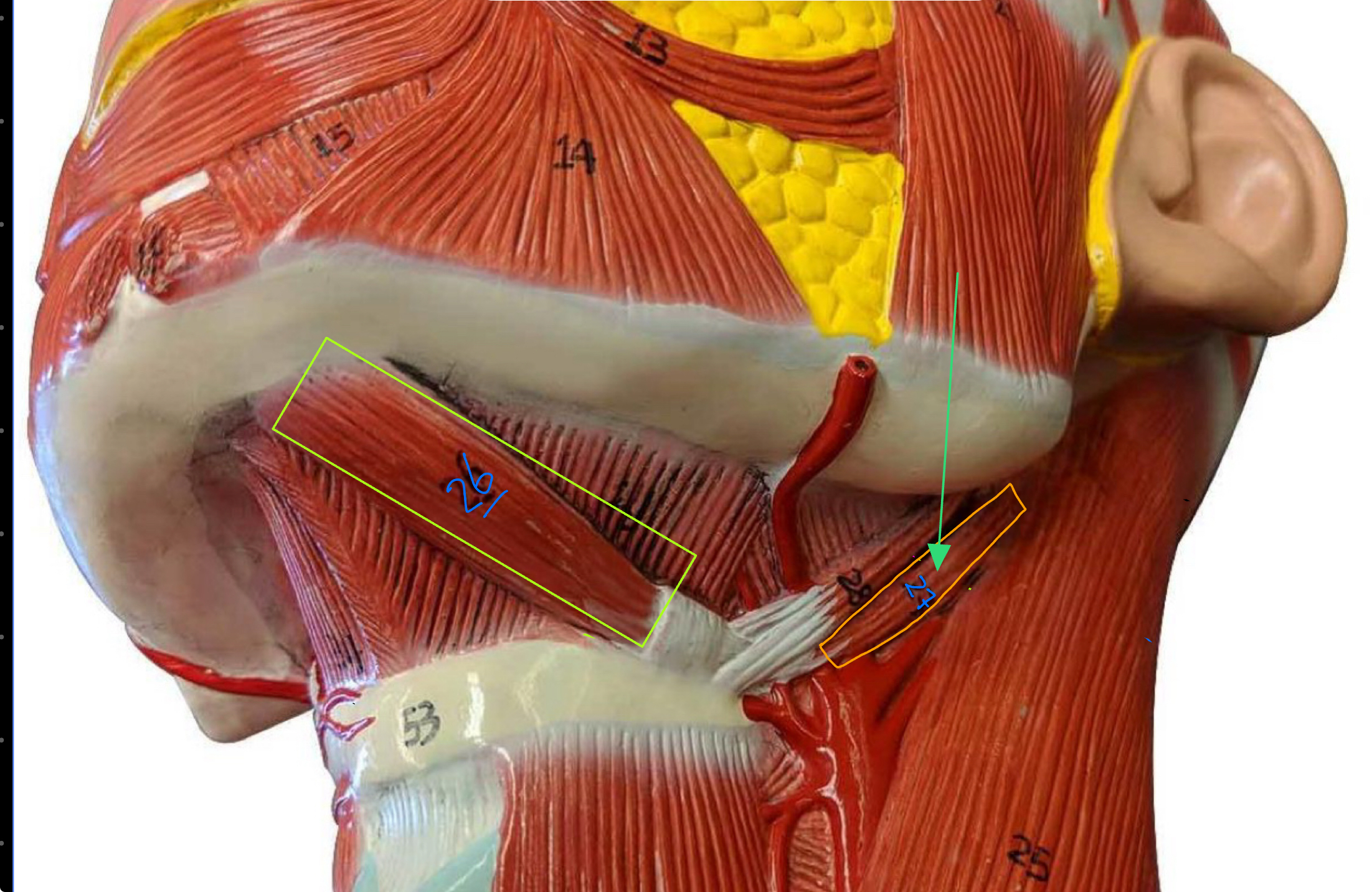 <p>What type of muscle is this ( altay model )</p>