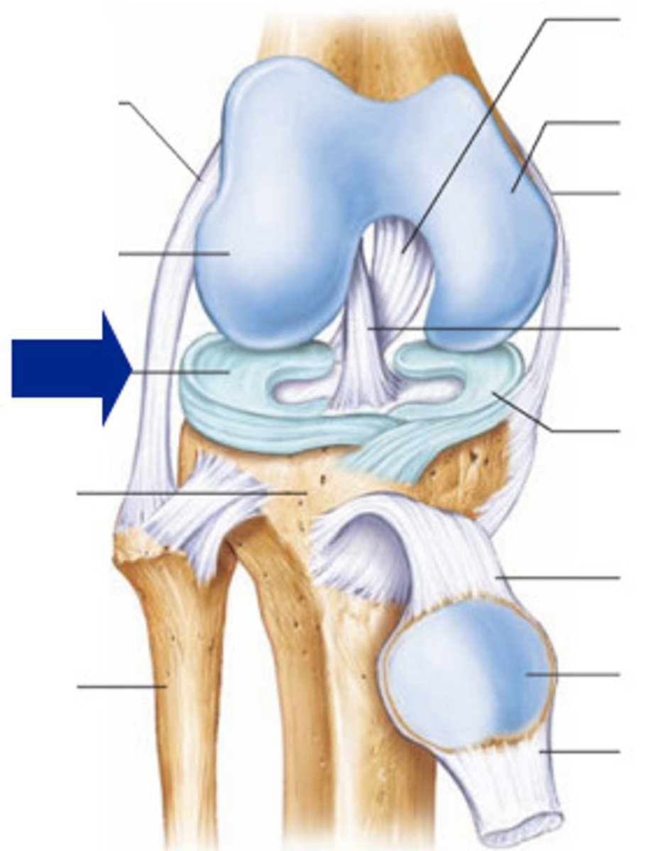 <p>A circular cartilage pad that cushions and stabilizes the lateral side of the knee.</p>