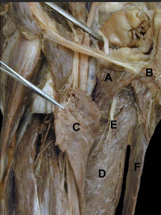 <p>Identify the structures on this <strong>Anterior View</strong> of the thigh’s <strong>Adductors</strong></p>