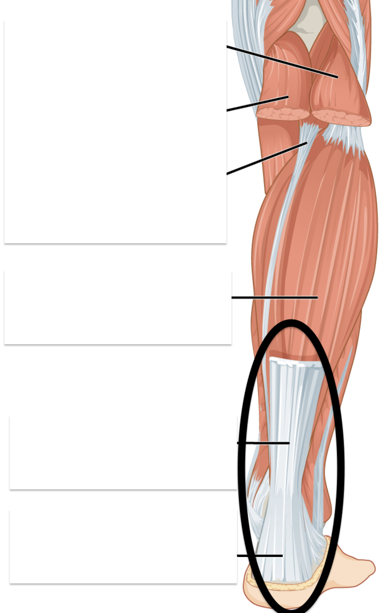 Also known as achilles tendon